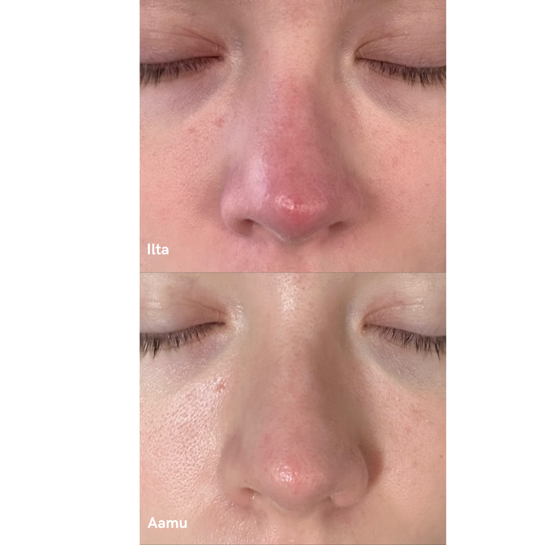 Purifying Mist + Face & Body - antiseptinen ja rauhoittava hoitosuihke - Vito Beauty