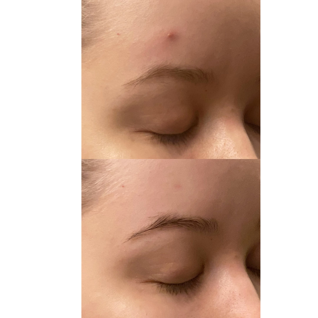 Purifying Mist + Face & Body - antiseptinen ja rauhoittava hoitosuihke - Vito Beauty
