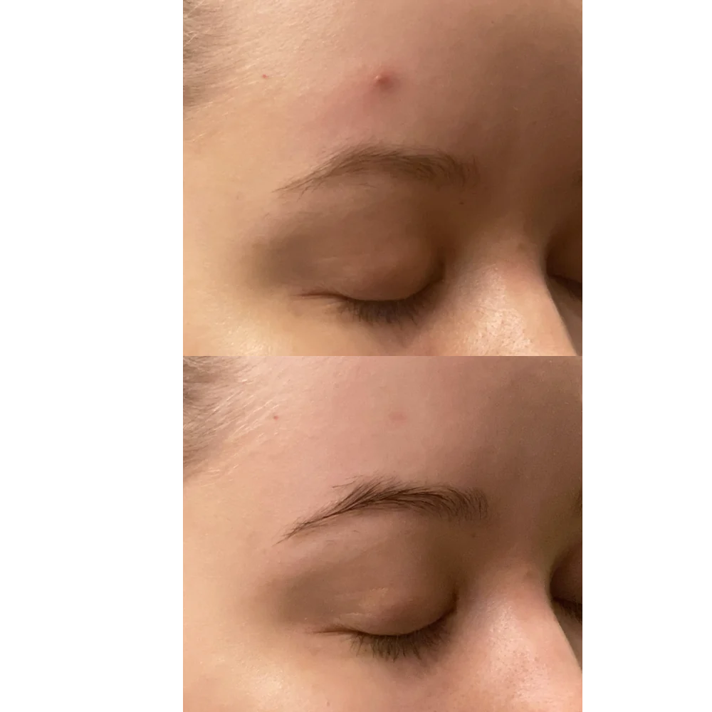 Purifying Mist + Face & Body - rauhoittava hypokloorihapposuihke