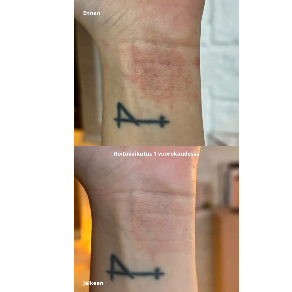 Purifying Mist + Face & Body - rauhoittava hypokloorihapposuihke